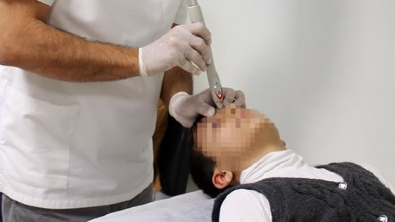 Obez ya da hiperaktif çocuğa akupunktur tedavisi